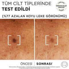 L'Oréal Paris Bright Reveal Sivilce, Güneş, Yaşlanma Lekelerinde Etkili Koyu Leke Karşıtı Serum 10% Niasinamid 30 ml