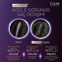 Clear Scalpceuticals Saç Bakım Şampuanı Saç Dökülmesine Karşı 300 ml